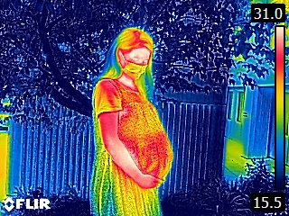Pregnancy thermal image A pregnant person