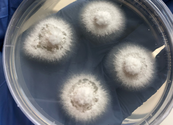 Fungal mycelia growing on an agar plate