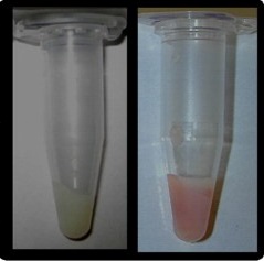 lactoferrin