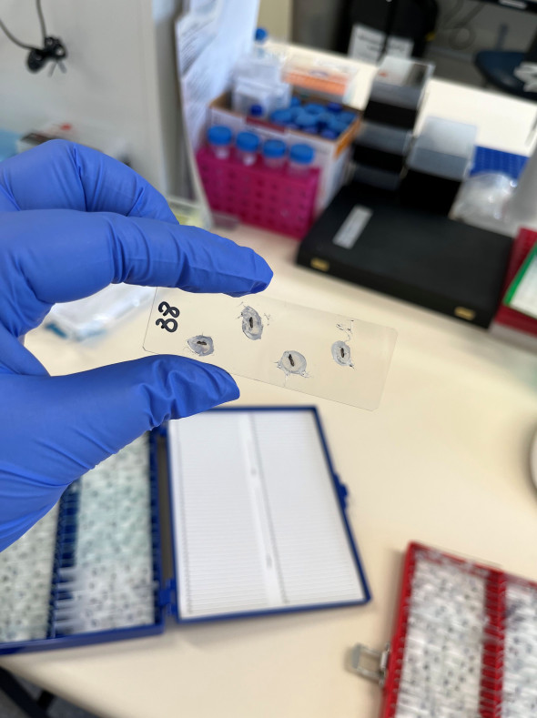 mounted otoliths resized